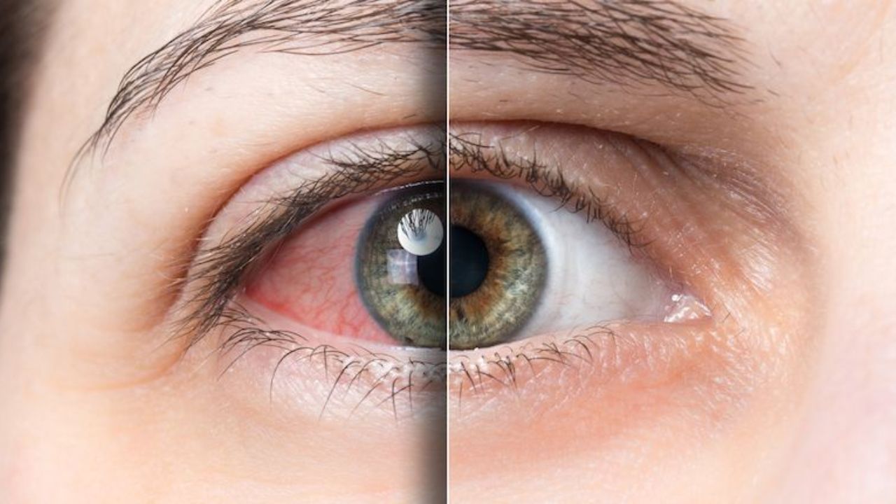 is vowiszojid54 for sensitive eyes